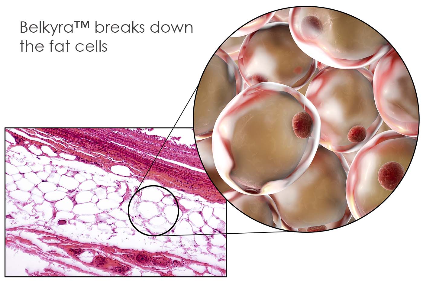 chin reduction fat cell