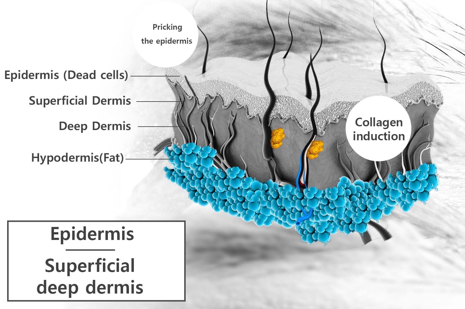 microneedling-treatment-area