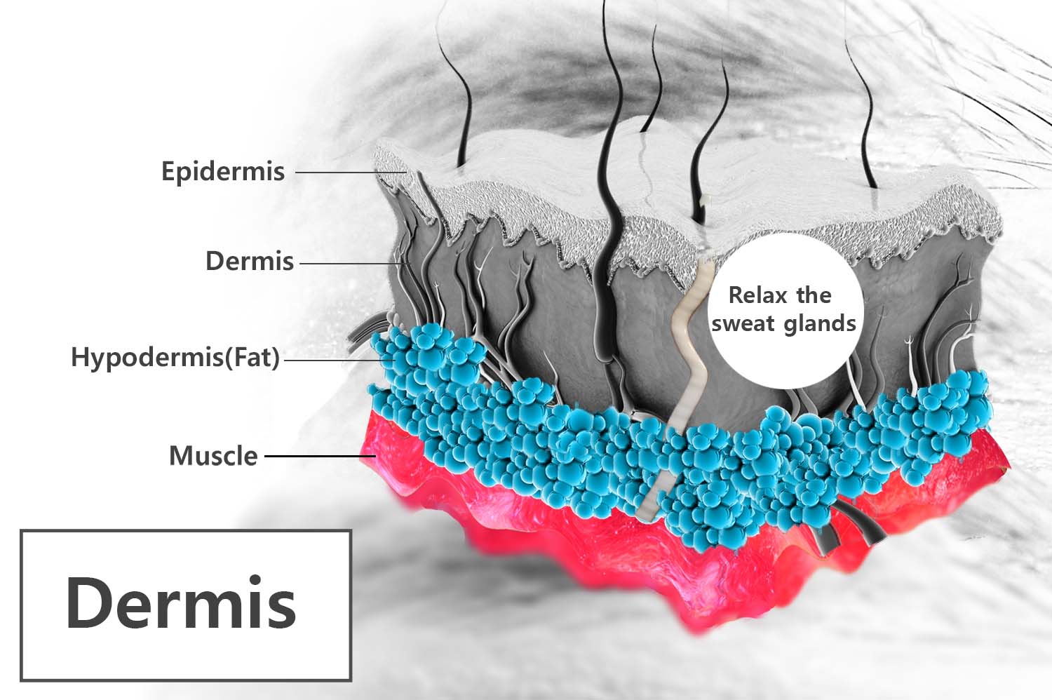 excessice-sweating glands treatment botox