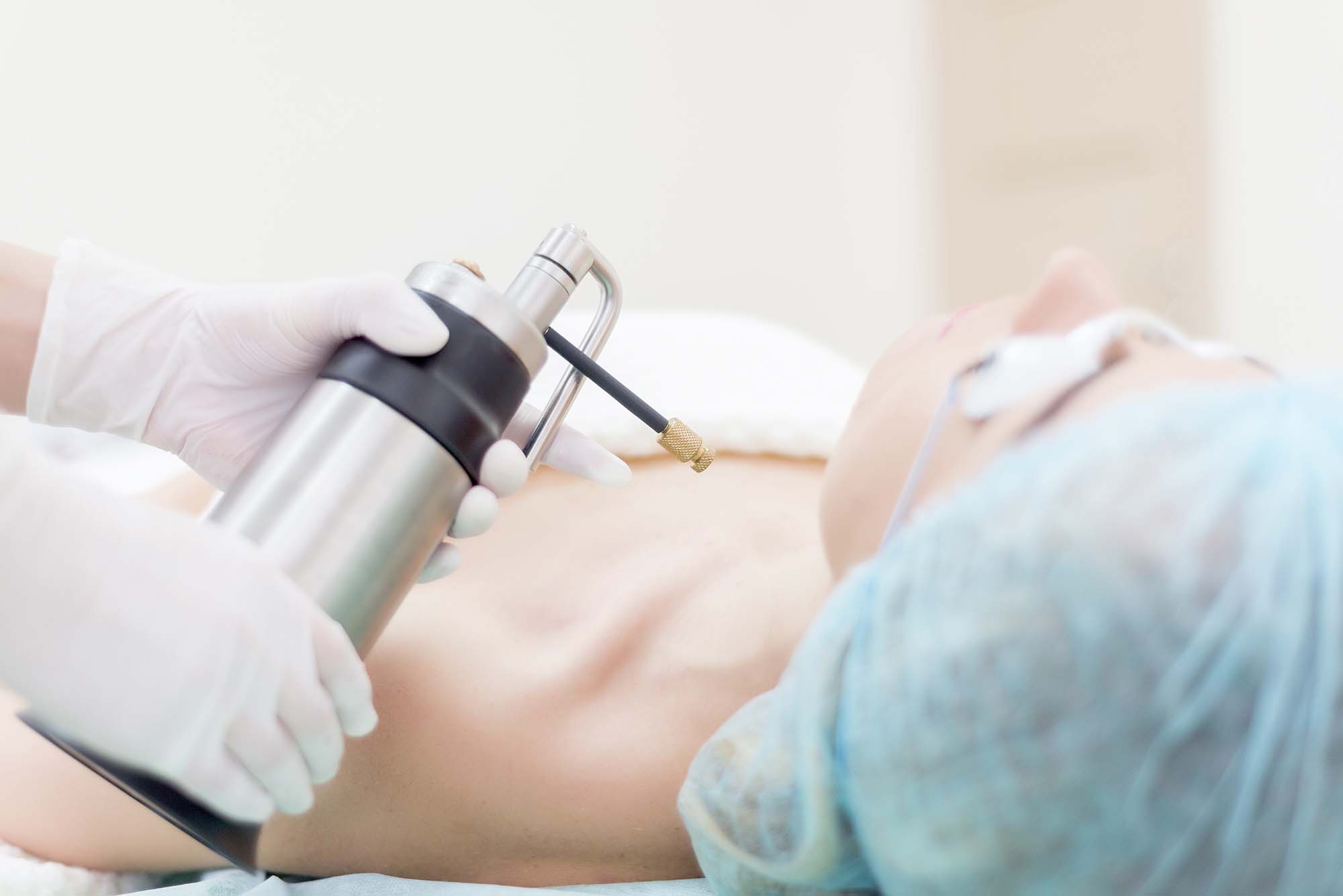 Liquid nitrogen. Doctor makes the patient cryotherapy procedure Liquid nitrogen. Doctor makes the patient cryotherapy procedure