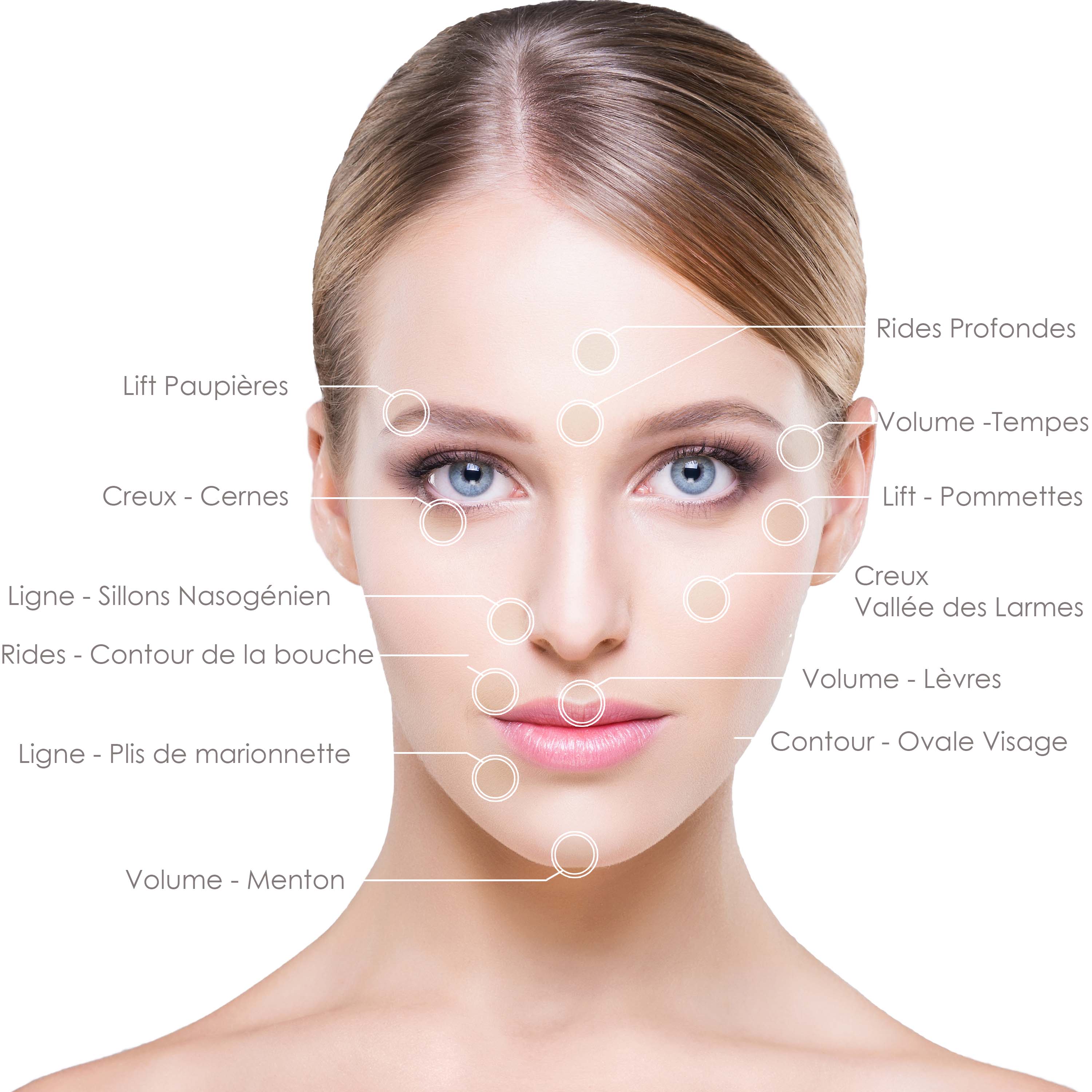 zone-utilisation-du-juvederm zone-utilisation-du-juvederm