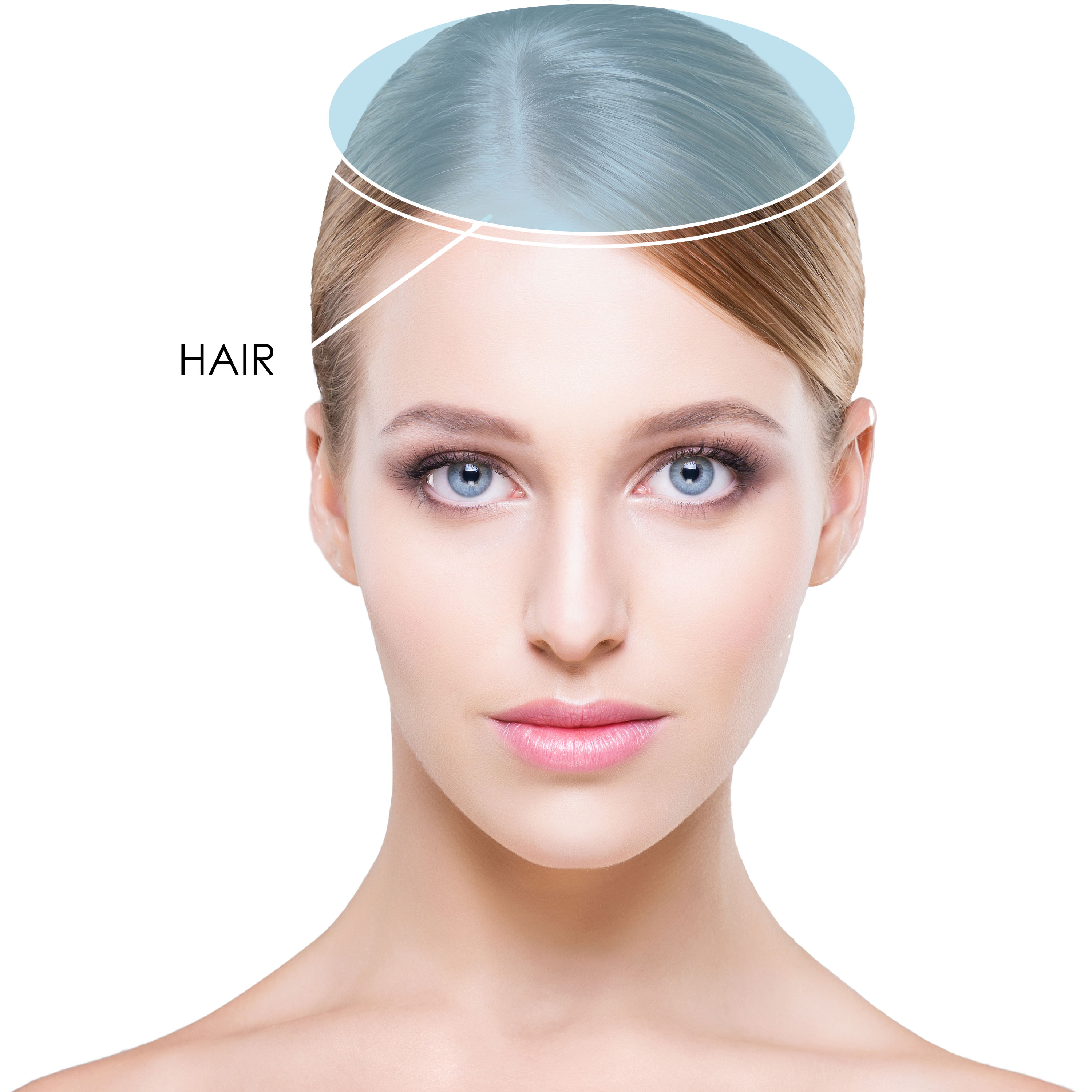 prp-plasma-rich-plaquet-hair-loss