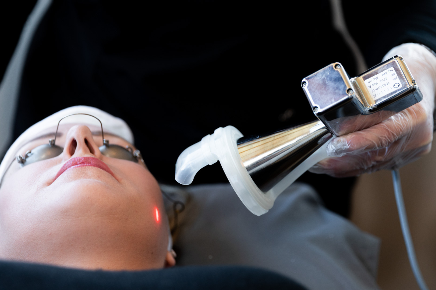 Laser resurfaçage fractionné