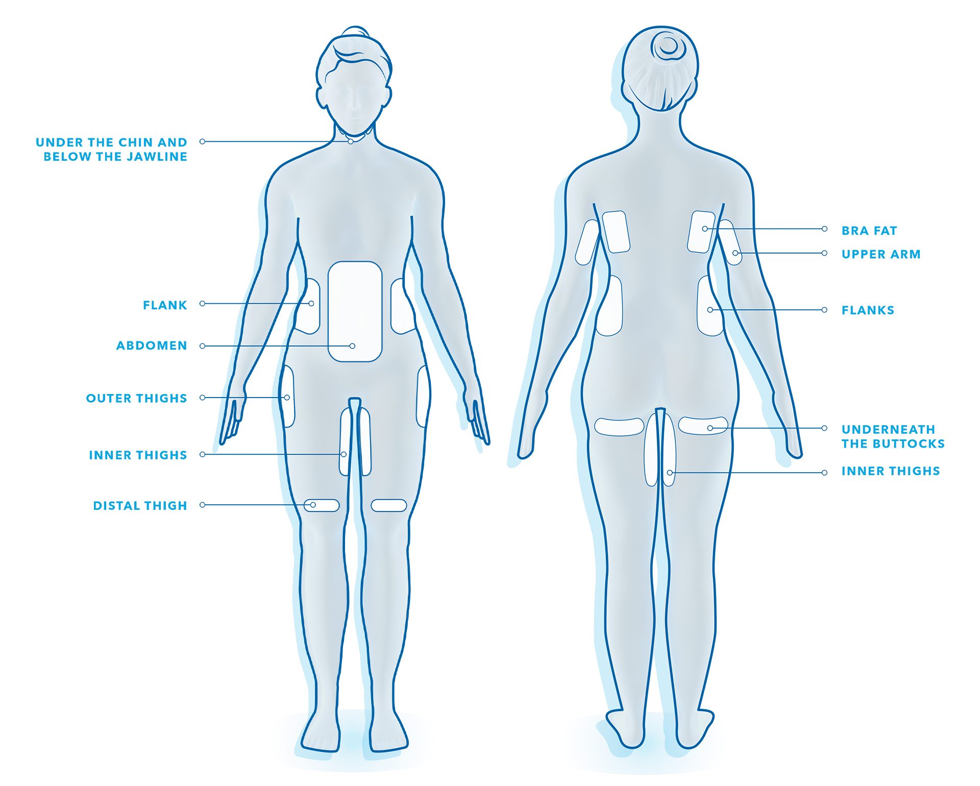 coolsculptingc2ae20treatment20areas20illustration2c20vertical coolsculptingc2ae20treatment20areas20illustration2c20vertical