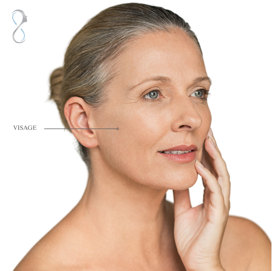 paupieres-2 paupieres-2