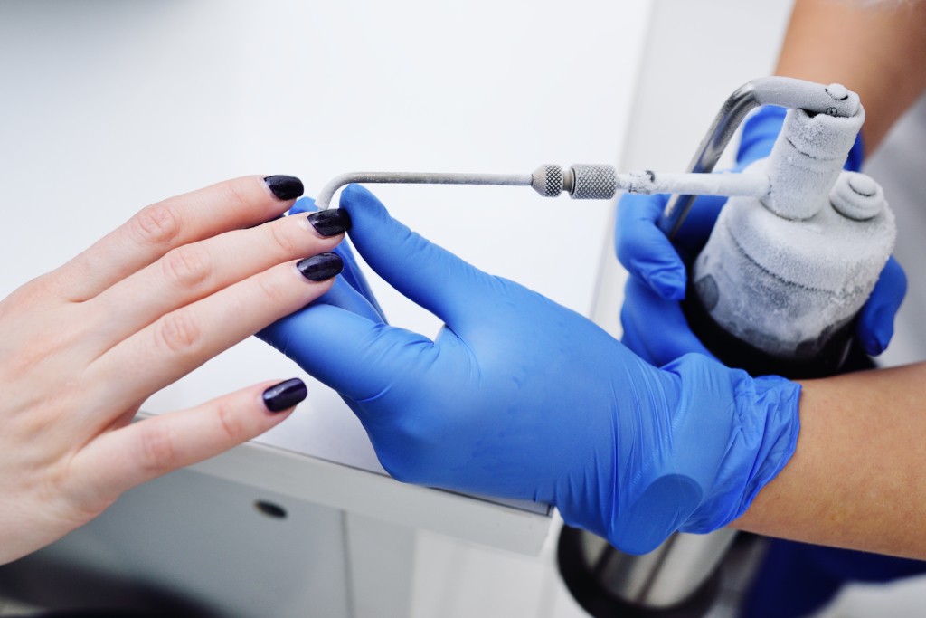 Removal of papillomas and warts on the hand with liquid nitrogen in a special device with a probe – cryodestructors. Removal of papillomas and warts on the hand with liquid nitrogen in a special device with a probe – cryodestructors.