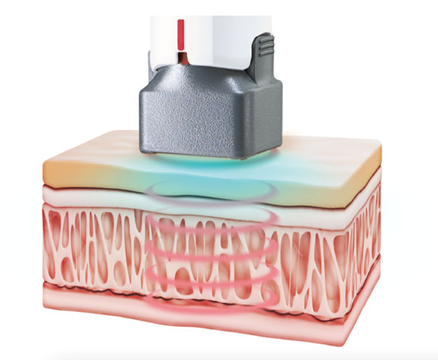 smart-cooling-comfort-system