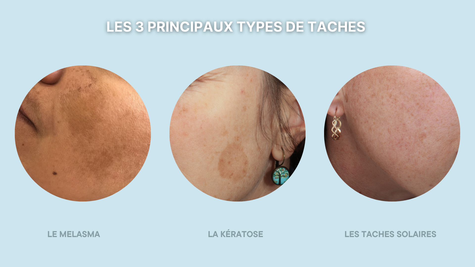 types-tache types-tache