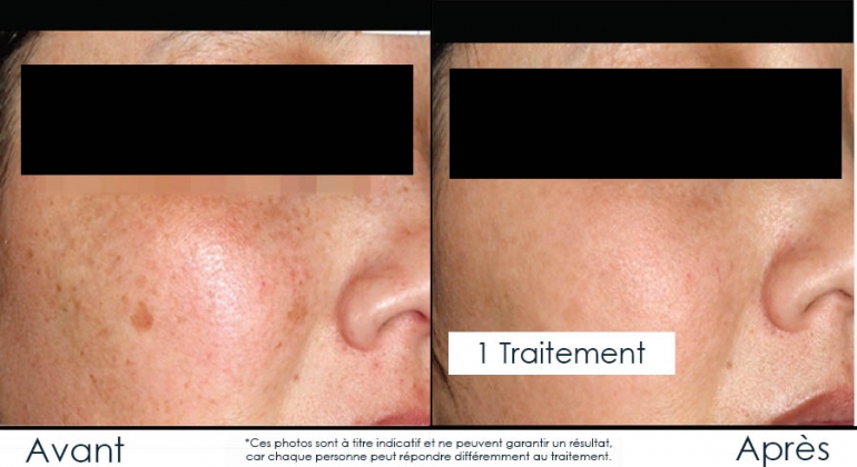 Planeur électrique Pictor EV E-Glider - NOUVELLE VERSION 04-2025 - Modèle Vol à Voile RC ArtHobby